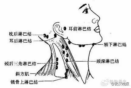 这三处的淋巴,决定生死,没事常摸摸它