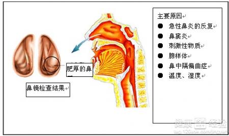 小儿患上鼻炎最根本的原因便是身体抵抗力差