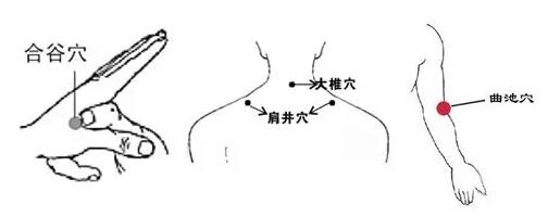 中医谈:深秋时节肩周炎再度来袭,该如何避免?