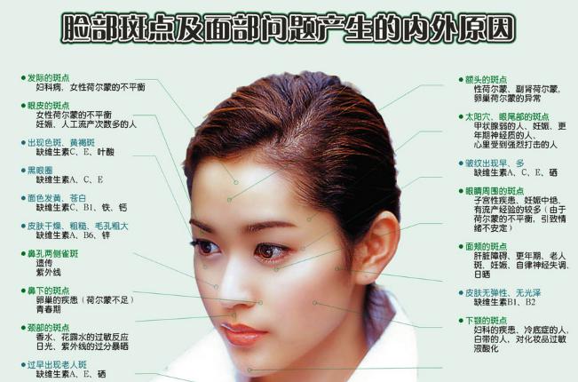 湘府养生：脸上各个部位长斑点的原因及食疗方法