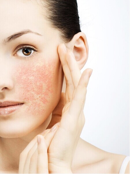 秋季如何抗过敏护肤方法皮肤过敏怎么办