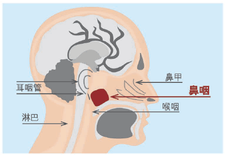 鼻咽癌的治疗及专业检查