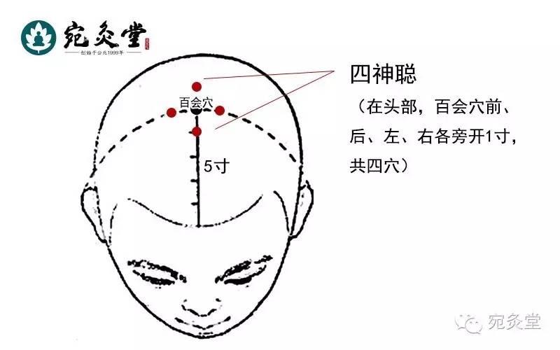 龙脊灸的原理_谁知道真正的归元灸原理是什么 效果如何