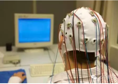 白日梦需警惕失神癫痫:脑电图来搜集证据!