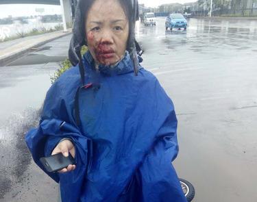 雨天骑车遇暗沟摔倒,沌口一受伤女子半边脸都是血