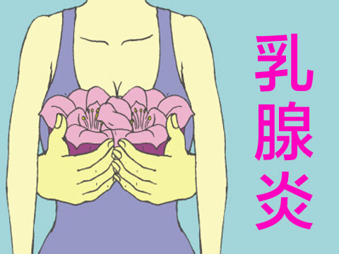 乳腺炎是什么症状?为什么会得乳腺炎?