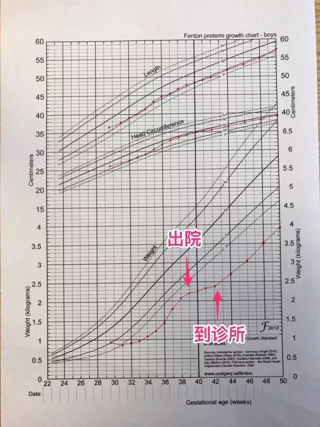 一个早产宝宝的追赶式成长