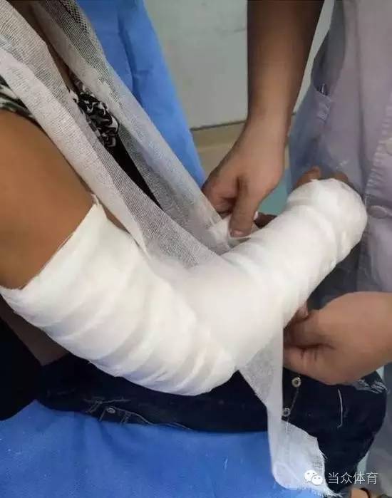 小张同学受伤的手臂