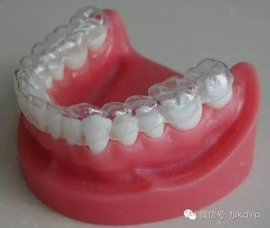 【口腔微学院】矫正完牙齿之后保持器要戴多久
