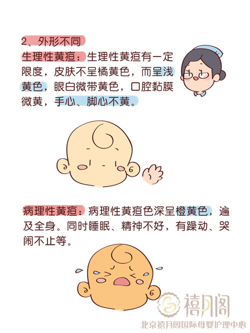 禧月阁自制新生儿黄疸爸爸妈妈知多少