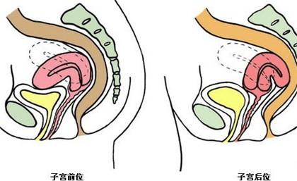 子宫的位置是位于女性身体的前倾位,也就是子宫底朝向耻骨,宫颈与宫