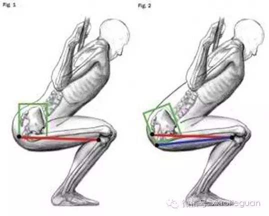 第282讲:深蹲时的屁股眨眼到底是什么?