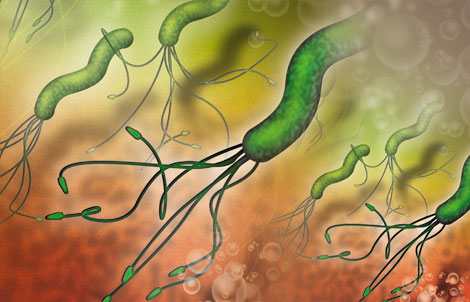 幽门螺杆菌的症状,该如何预防幽门螺杆菌?