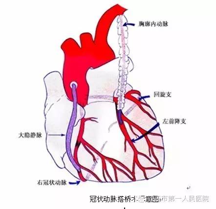 心脏搭脉怎么治疗_心脏位置