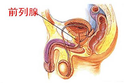 性欲亢进和前列腺炎有什么关系