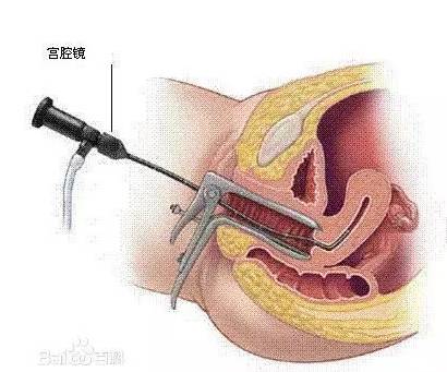 产妇该听谁?“纱布门事件“不得不说的关键知识 附最新消息-搜狐健康