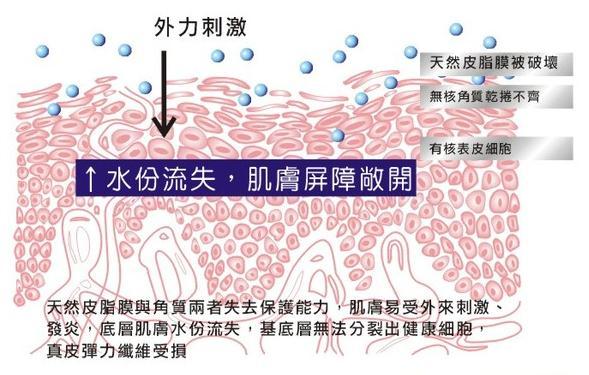 缺水长痘过敏问题不断?肯定是你皮肤屏障受损了!-新闻视点-人工智能实验室-中国人工智能网