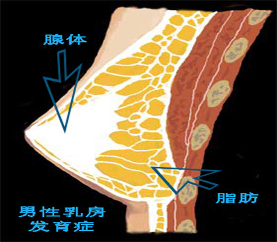 使腺   男性乳腺发育后,其腺体成份主要集中于乳头乳晕复合体的深面处