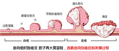肠息肉就是肠黏膜表面隆起性的病变,通俗地说,是长在肠管内的一个肉