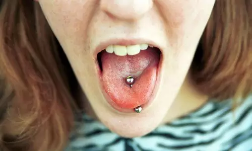 tongue是什么意思