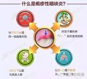 亲吻孩子就得疱疹性咽峡炎?大夫这样告诉你!