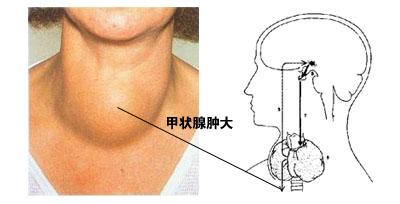 胸口感觉有东西噎着