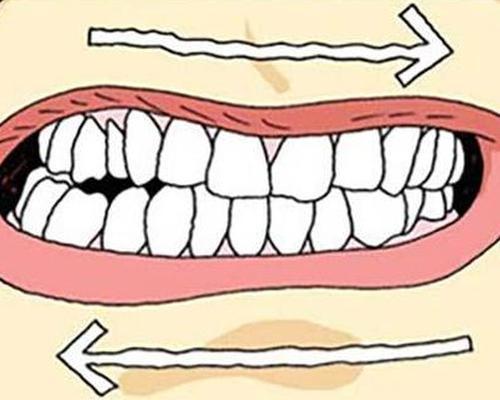 磨牙问题的解答都在这里了!
