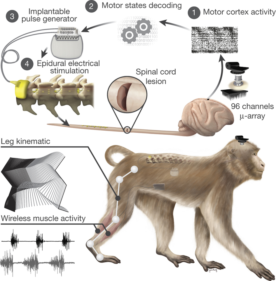 重大突破:科学家让截瘫猴重新走路