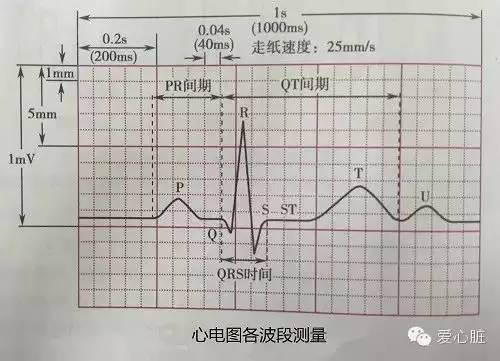 看懂心电图,就这么简单!