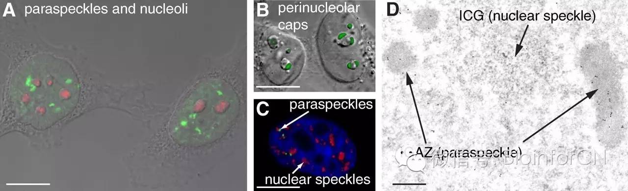 艺术细胞#paraspeckles: 细胞核内lncrna重要功能体