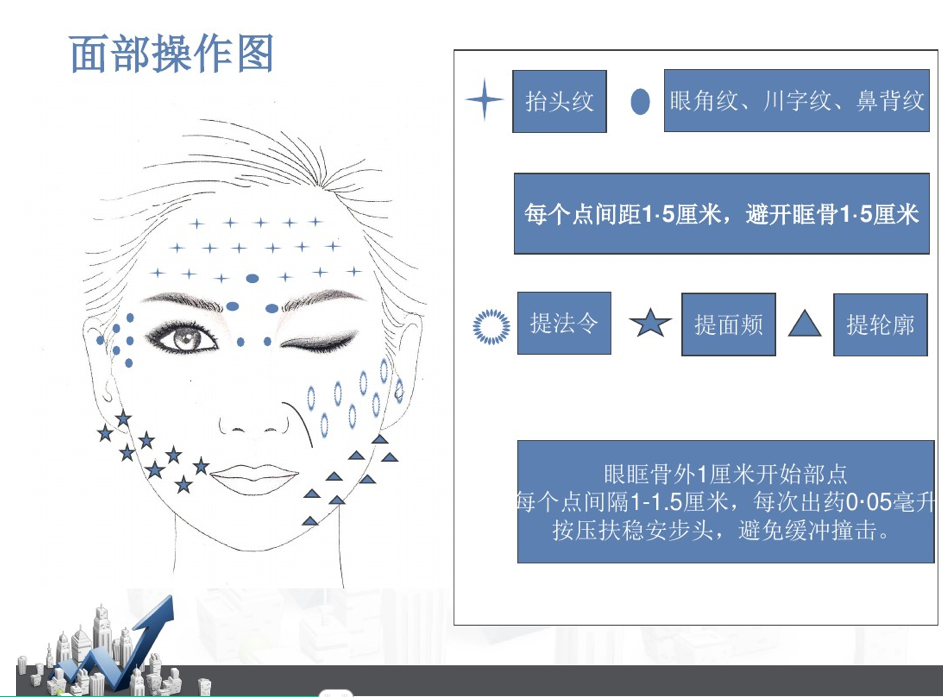 多肽雾化微雕祛皱抬头纹鱼尾纹面部微雕三线提升术