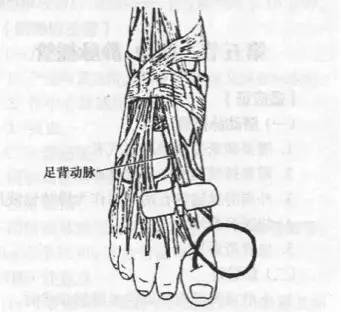 图 7. 颞动脉穿刺 足背动脉穿刺 1.