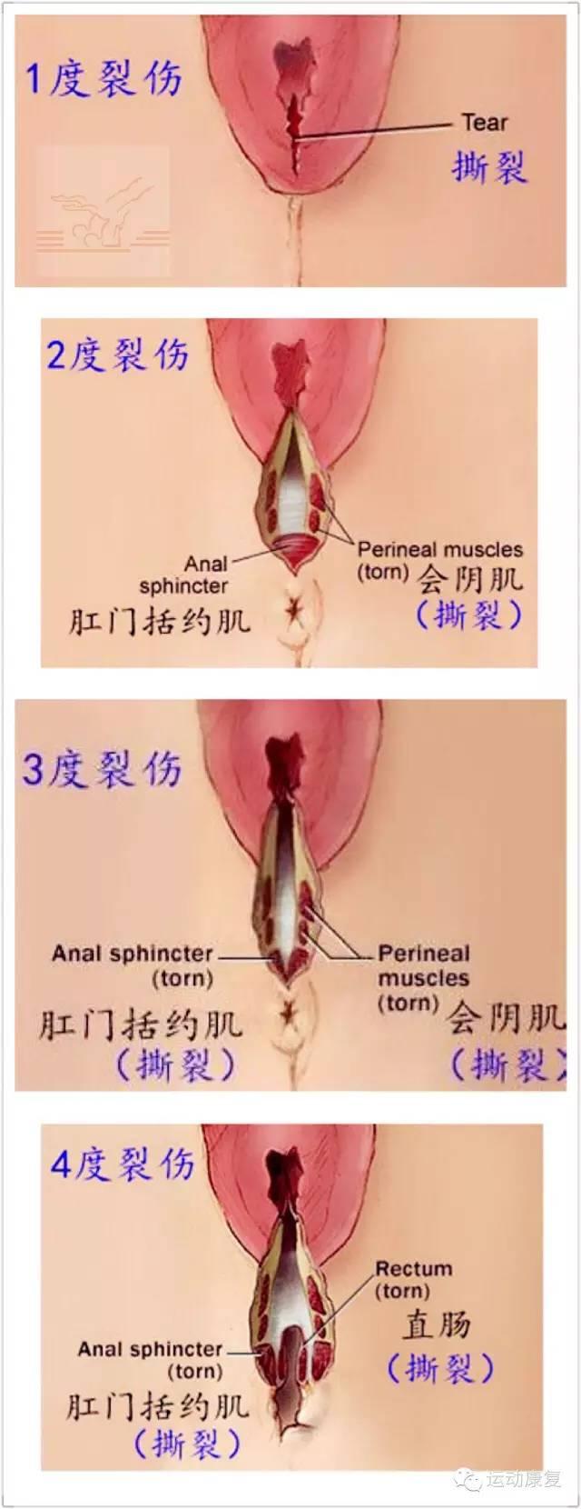 "产后康复"在怀孕32周以后,就应该开始了!