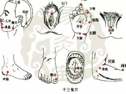 十三鬼穴—在针灸界的神奇作用