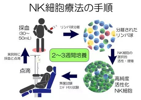 日本最先端癌症防治:高活性NK治疗,提高自身免