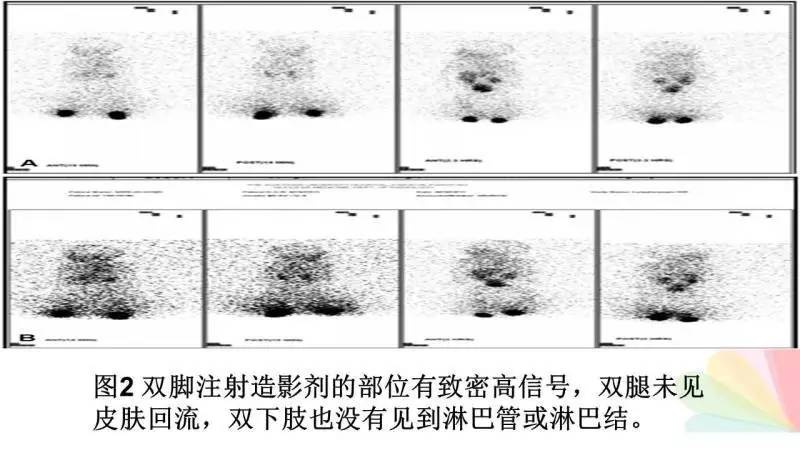 什么生脚成语_成语故事图片(3)