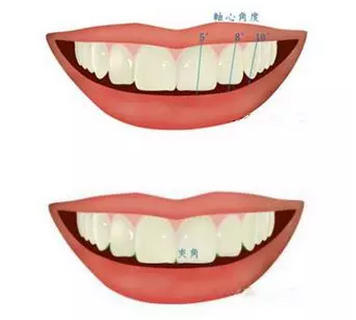 4:牙齿的角度   漂亮牙齿的排列角度,与齿轴的倾斜角度有关,牙齿排 