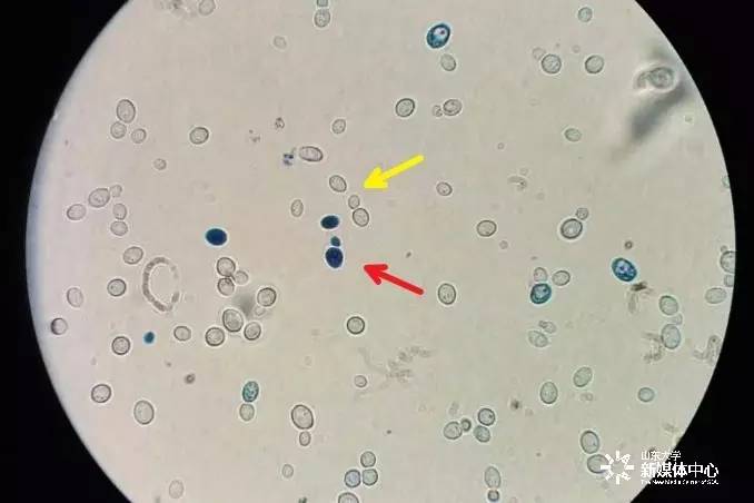 酵母菌染色观察实验在大二开展,在显微镜下,蓝色的酵母菌是死的,透明