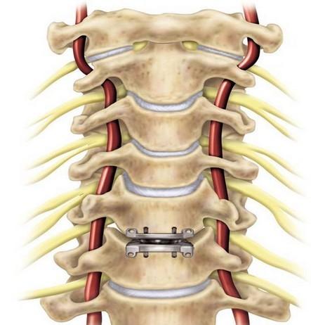 脊柱、脊髓解剖与损伤特点