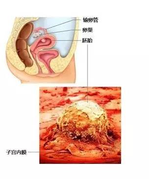 胚胎着床失败可能的原因 那么,为什么有些患者的胚胎成功着床,有些