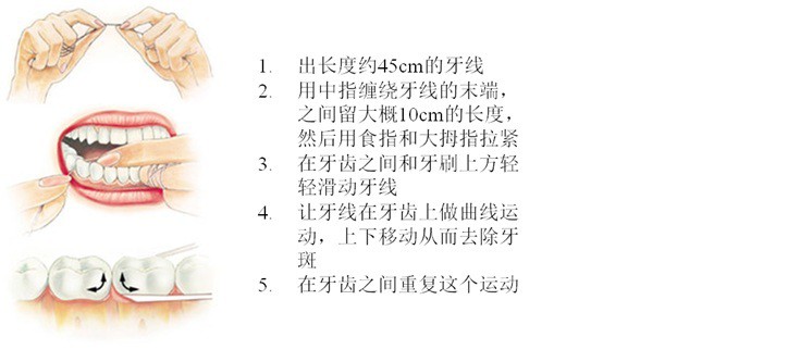 幸福健康小习惯get:使用牙线清洁牙齿