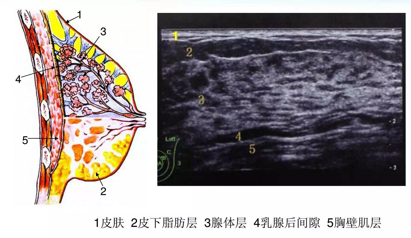 健康宣教"超声医学科专家告诉您—乳腺结节如何定性?