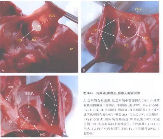 出生后不久后静脉导管关闭,卵圆孔,动脉导管相继闭合,新生儿的血液