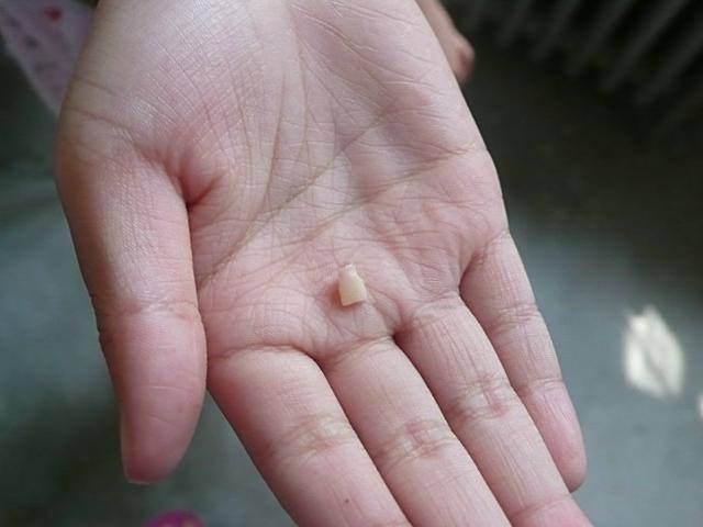 一般情况下,第一颗乳牙脱落是发生在孩子6岁的时候.