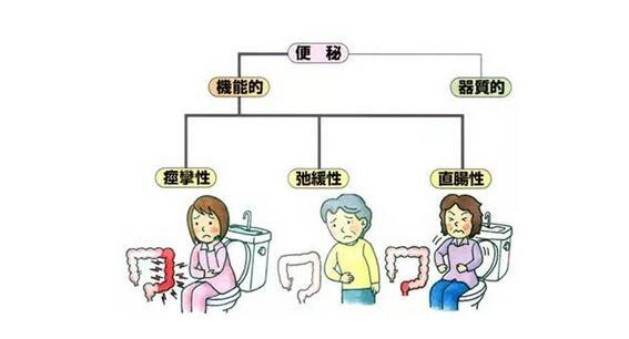 便秘在程度上有轻有重,在时间上可以是暂时的,也可以是长久的.