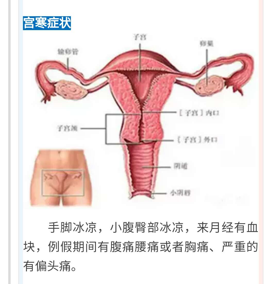 宫寒是女性一辈子的痛,懂它,才能防治它!