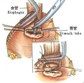 食管癌病人口水_食管癌晚期病人图片(3)