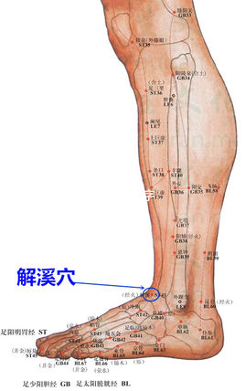 王氏三棱针刺血疗法治急性感染性多发性神经根炎