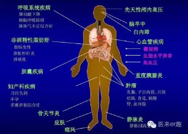 中国肥胖人口已位居世界首位,你知道它的危害吗?