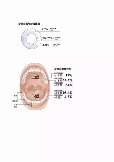 《口腔医学》杂志上发表过论文《牙隐裂的临床观察和病因分析》,对102